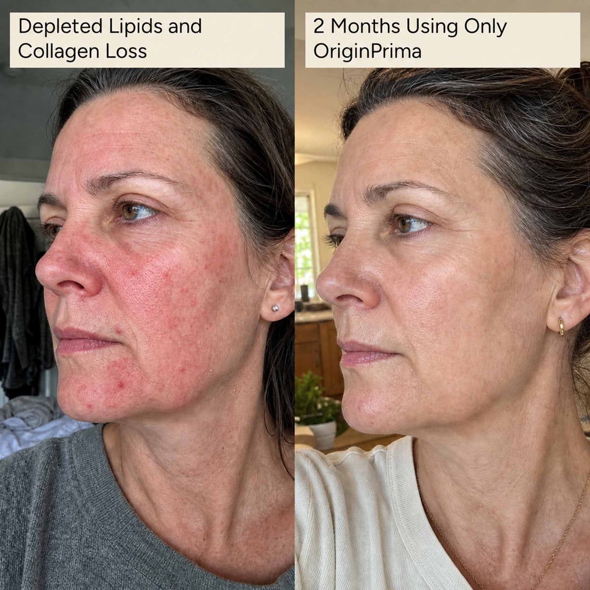 Complete Skin Identical Restoration System